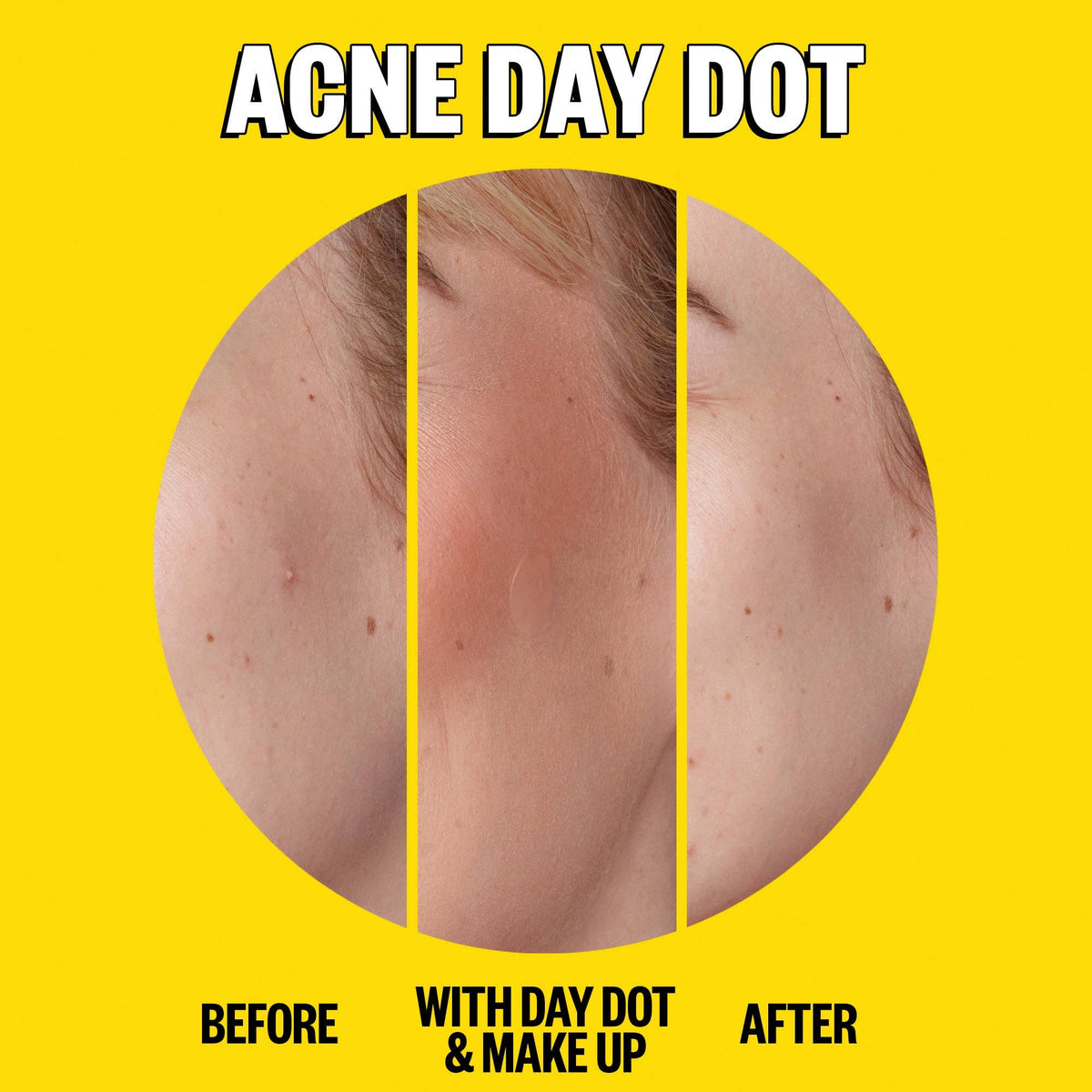 Peace Out Skincare - Acne Day & Night Duo