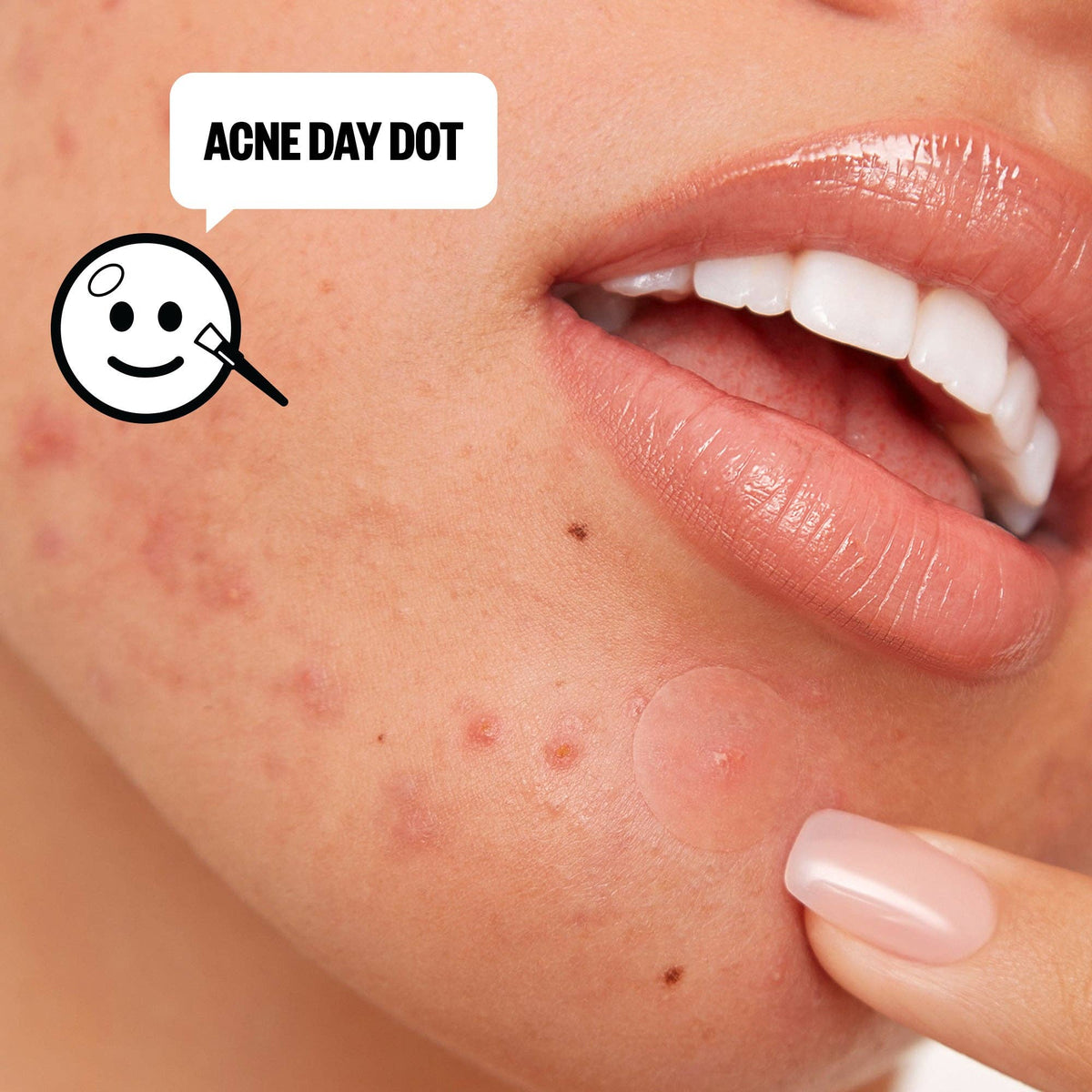 Peace Out Skincare - Acne Day & Night Duo