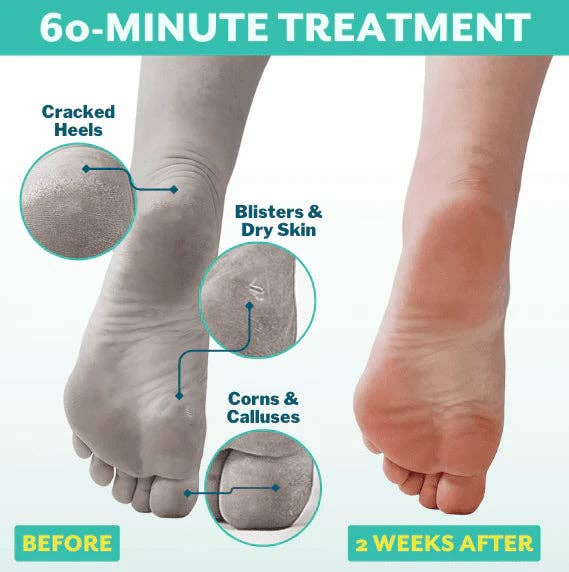 Patchology - PoshPeel™ Pedi Cure