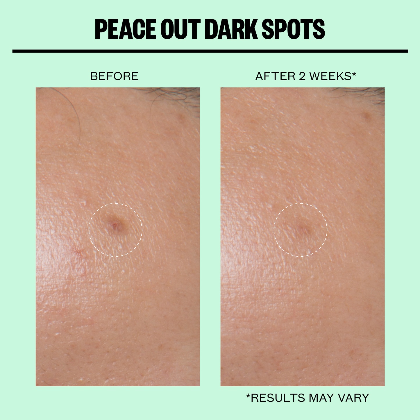 Peace Out Skincare - Dark Spots Microneedling Dots