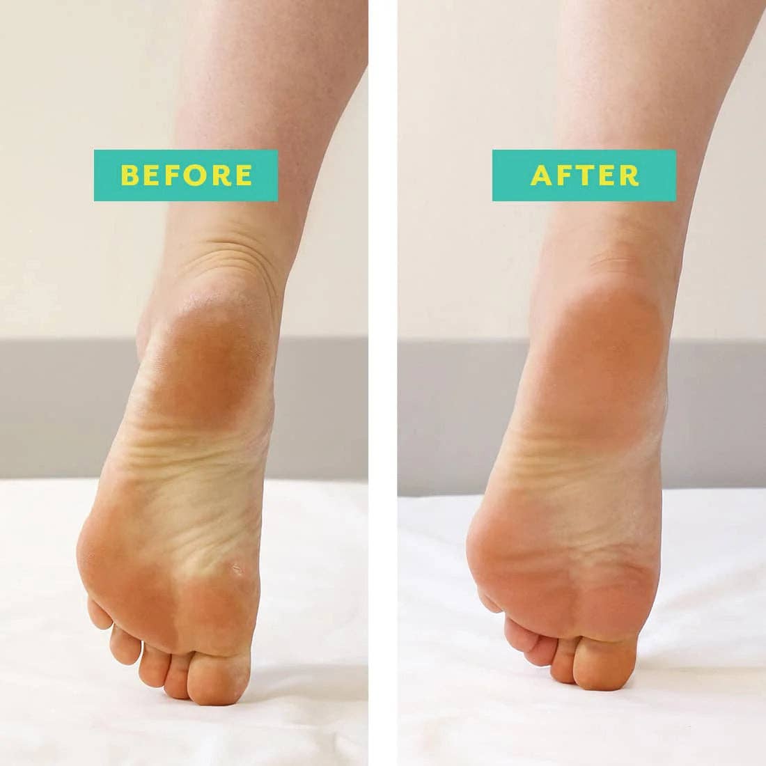Patchology - PoshPeel™ Pedi Cure